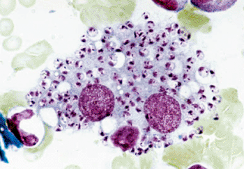 Image: Leishmania amastigotes (Photo courtesy of the US Centers for Disease Control and Prevention).